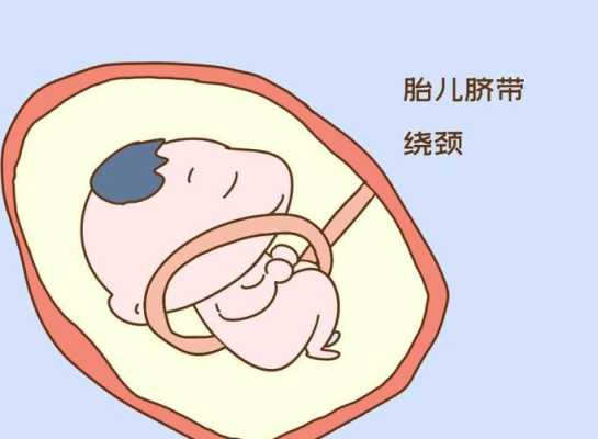 胎儿脐带绕颈一周是什么意思(胎儿脐带绕颈一周怎么才能转过来) 第1张 胎儿脐带绕颈一周是什么意思(胎儿脐带绕颈一周怎么才能转过来) 第1张