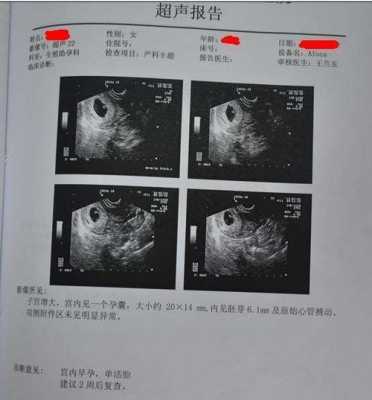 孕期怎么知道男女(孕期怎么知道男女宝宝性别) 第3张 孕期怎么知道男女(孕期怎么知道男女宝宝性别) 第3张