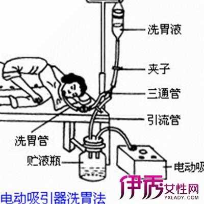 胎儿洗胃(胎儿洗胃怎么洗) 第1张 胎儿洗胃(胎儿洗胃怎么洗) 第1张