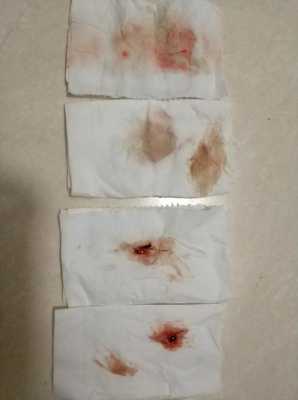 孕期末次月经(什么叫做末次月经) 第2张 孕期末次月经(什么叫做末次月经) 第2张