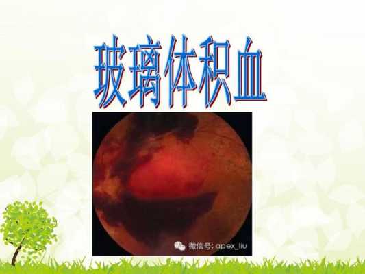 盆腔积血是怎么回事,孕期盆腔积血是怎么引起的  第2张