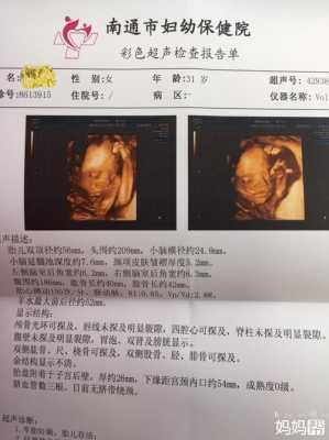 四维彩超上面写的见切面是什么意思啊,胎儿面部切面显示不清,胎儿四肢不能全部显示  第1张