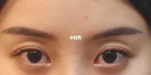 胎儿眼窝深(胎儿眼窝深是不是眼睛就大) 第1张 胎儿眼窝深(胎儿眼窝深是不是眼睛就大) 第1张