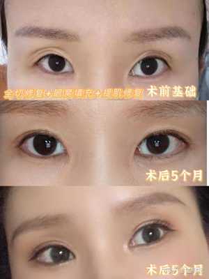 胎儿眼窝深(胎儿眼窝深是不是眼睛就大) 第2张 胎儿眼窝深(胎儿眼窝深是不是眼睛就大) 第2张