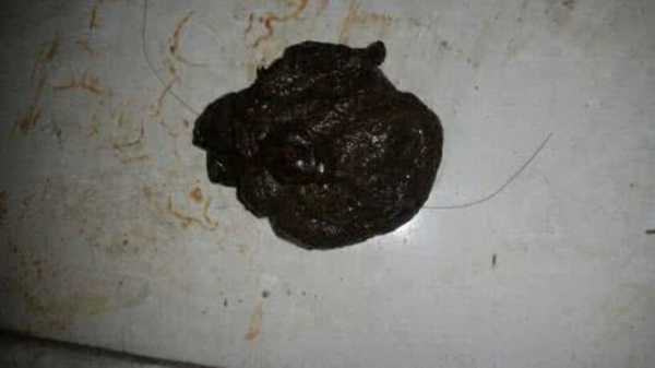 孕期便便黑色(怀孕后拉的便便一直是黑色的,怎么回事) 第3张 孕期便便黑色(怀孕后拉的便便一直是黑色的,怎么回事) 第3张