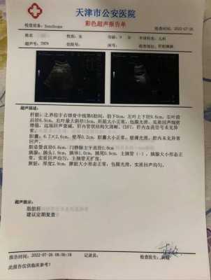 胎儿平均体重(b超体重跟胎儿实际体重相差多少) 第1张 胎儿平均体重(b超体重跟胎儿实际体重相差多少) 第1张