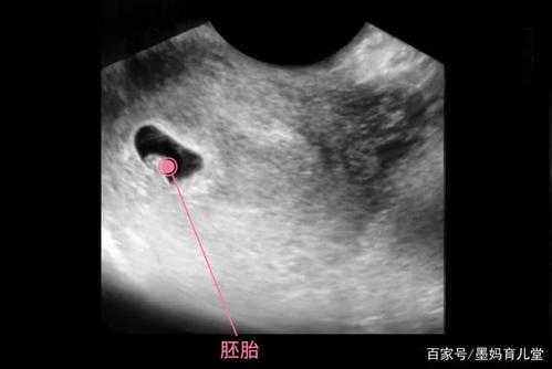 孕期第6周(孕期第6周的模样) 第2张 孕期第6周(孕期第6周的模样) 第2张
