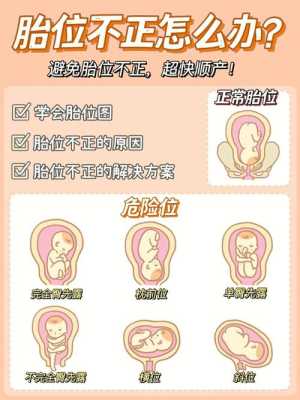 胎儿胎位低(胎儿胎位低有什么影响) 第1张 胎儿胎位低(胎儿胎位低有什么影响) 第1张
