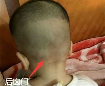胎儿脑门宽(胎儿脑门宽 生下来会变小吗) 第2张 胎儿脑门宽(胎儿脑门宽 生下来会变小吗) 第2张