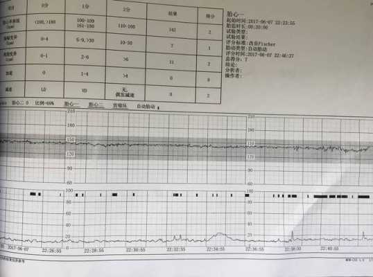 胎儿基线平（胎儿基线平是什么意思）  第1张