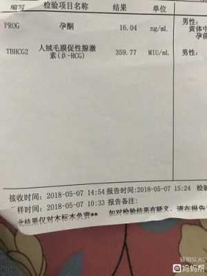请问,孕妇怀孕时血液中可以检测出胎儿DNA,胎儿鉴别验血报告 第2张 请问,孕妇怀孕时血液中可以检测出胎儿DNA,胎儿鉴别验血报告 第2张