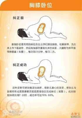 胎位rop怎样纠正,胎儿后侧位是什么意思 第1张 胎位rop怎样纠正,胎儿后侧位是什么意思 第1张