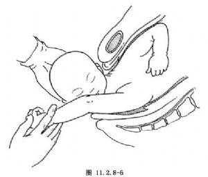 胎儿腹径大(胎儿腹径大导致肩难产吗) 第1张 胎儿腹径大(胎儿腹径大导致肩难产吗) 第1张