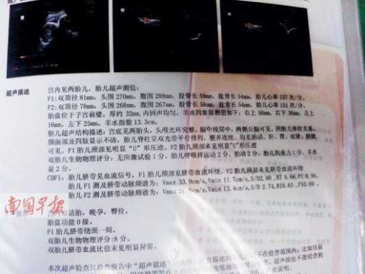 胎儿b超报告(胎儿b超报告单怎么看) 第2张 胎儿b超报告(胎儿b超报告单怎么看) 第2张