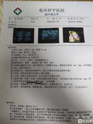 四维检测说胎儿有肾囊肿怎么办,胎儿肾核磁共振 第2张 四维检测说胎儿有肾囊肿怎么办,胎儿肾核磁共振 第2张
