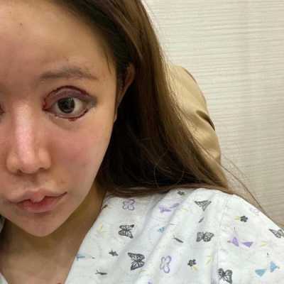 为什么孩子抱起来总张大嘴巴,胎儿张大嘴在干什么 第3张 为什么孩子抱起来总张大嘴巴,胎儿张大嘴在干什么 第3张