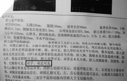 b超mi是什么意思,胎儿b超指数参考 第3张 b超mi是什么意思,胎儿b超指数参考 第3张