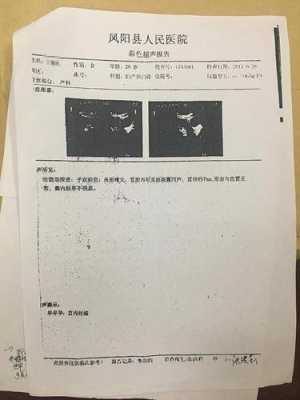 b超mi是什么意思,胎儿b超指数参考 第1张 b超mi是什么意思,胎儿b超指数参考 第1张