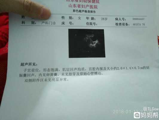胎儿没有心管搏动(胎儿没有心管搏动) 第1张 胎儿没有心管搏动(胎儿没有心管搏动) 第1张
