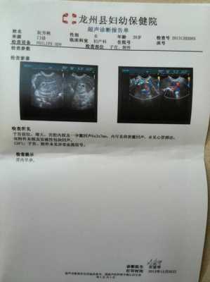 胎儿没有心管搏动(胎儿没有心管搏动) 第2张 胎儿没有心管搏动(胎儿没有心管搏动) 第2张