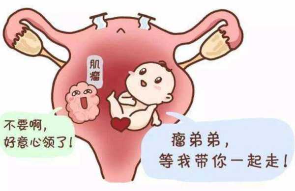 孕期子宫肌瘤注意(怀孕有子宫肌瘤有影响吗) 第2张 孕期子宫肌瘤注意(怀孕有子宫肌瘤有影响吗) 第2张