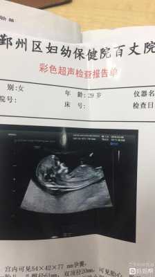 鼻骨未显示怎么回事,胎儿鼻骨未见显示什么意思  第1张