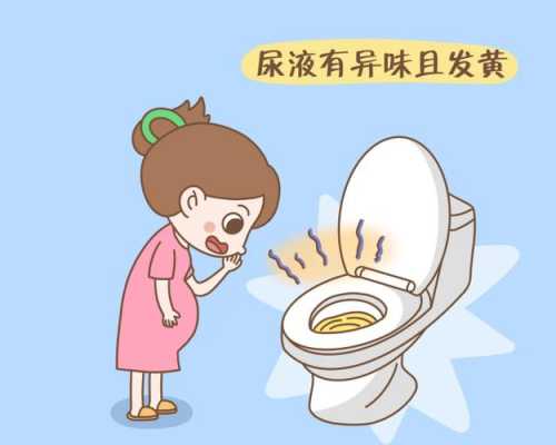 孕期尿有异味(孕期尿有异味儿是怎么回事) 第2张 孕期尿有异味(孕期尿有异味儿是怎么回事) 第2张