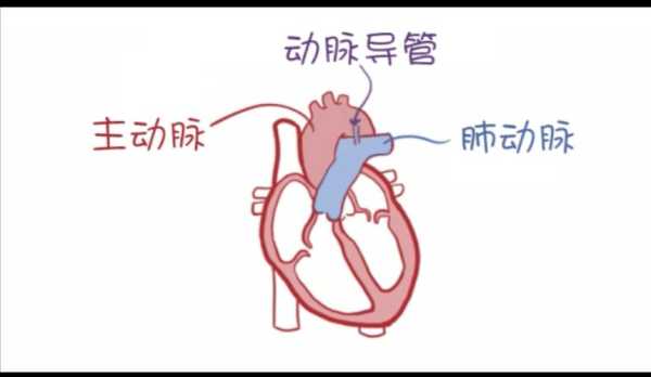 乳腺导管增宽是怎么回事,胎儿动脉导管增宽原因 第1张 乳腺导管增宽是怎么回事,胎儿动脉导管增宽原因 第1张
