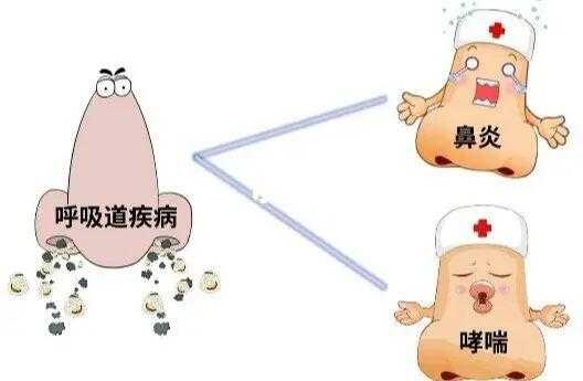 孕期鼻炎症状(孕期鼻炎症状有哪些) 第1张 孕期鼻炎症状(孕期鼻炎症状有哪些) 第1张