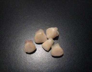 一周胎儿图(宝宝一周八个月了才长了七颗牙,怎么办?跟什么有关系) 第2张 一周胎儿图(宝宝一周八个月了才长了七颗牙,怎么办?跟什么有关系) 第2张