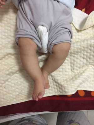 胎儿头偏大腿偏短(胎儿头偏大腿偏短是什么原因) 第1张 胎儿头偏大腿偏短(胎儿头偏大腿偏短是什么原因) 第1张