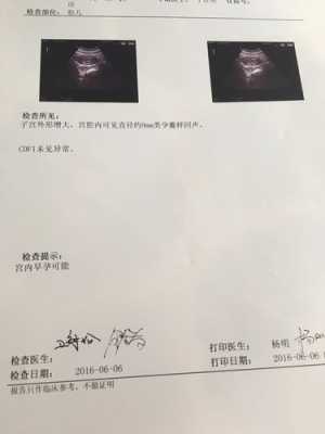 请问CDFI:探及胎心血流信号是什么意思,cdfi是胎儿的什么意思 第2张 请问CDFI:探及胎心血流信号是什么意思,cdfi是胎儿的什么意思 第2张