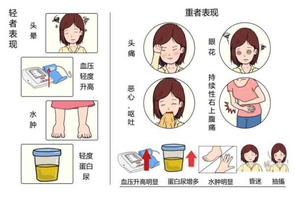 孕期如何降血压(孕期如何降血压最有效) 第1张 孕期如何降血压(孕期如何降血压最有效) 第1张