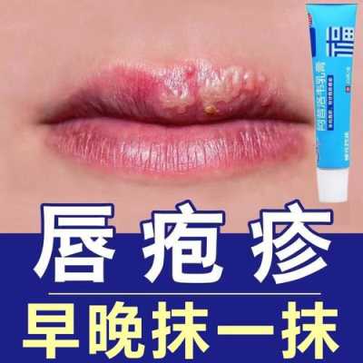 有孕期长了口唇疱疹的吗,孕期嘴唇疱疹可以擦什么药  第2张
