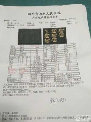 胎儿左侧侧脑室高值(胎儿侧脑室宽度正常值是多少) 第2张 胎儿左侧侧脑室高值(胎儿侧脑室宽度正常值是多少) 第2张