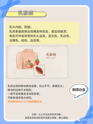 乳腺增生是怎么得的,孕期会乳腺增生吗? 第2张 乳腺增生是怎么得的,孕期会乳腺增生吗? 第2张