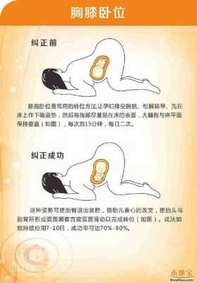 孩子臀位如何矫正,胎儿殿位有什么影响 第2张 孩子臀位如何矫正,胎儿殿位有什么影响 第2张