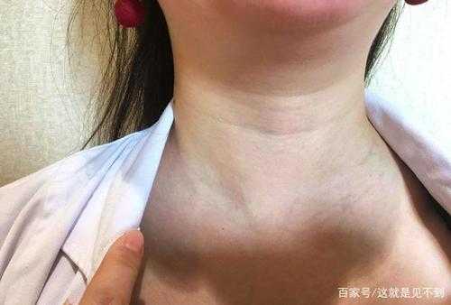 胎儿颈部厚怎么造成的(九个月的宝宝脖子手心脚发热怎么回事) 第1张 胎儿颈部厚怎么造成的(九个月的宝宝脖子手心脚发热怎么回事) 第1张