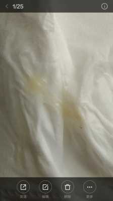 怀孕期间白带发黄对宝宝有影响吗, 第1张 怀孕期间白带发黄对宝宝有影响吗, 第1张