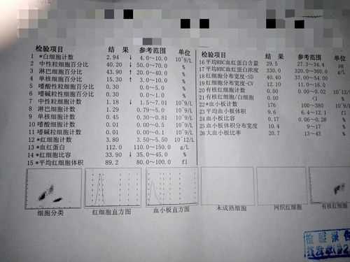 白细胞高对胎儿危害(孕妇血常规白细胞高的原因是什么?怎么办) 第2张 白细胞高对胎儿危害(孕妇血常规白细胞高的原因是什么?怎么办) 第2张