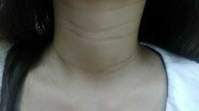 孕期脖子变黑长纹(孕妇脖子变黑是怎么回事呢?正常的吗) 第2张 孕期脖子变黑长纹(孕妇脖子变黑是怎么回事呢?正常的吗) 第2张