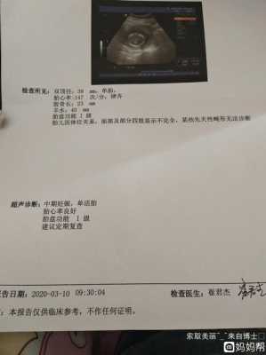 胎儿和妈妈面对面(检查说宝宝和妈妈面对面就是女孩对吗) 第2张 胎儿和妈妈面对面(检查说宝宝和妈妈面对面就是女孩对吗) 第2张