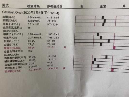 孕期白球比偏低(ag比值名词解释) 第1张 孕期白球比偏低(ag比值名词解释) 第1张