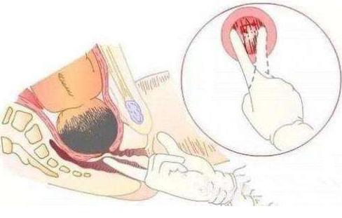 孕期内检是什么(孕期内检是什么时候做的) 第1张 孕期内检是什么(孕期内检是什么时候做的) 第1张