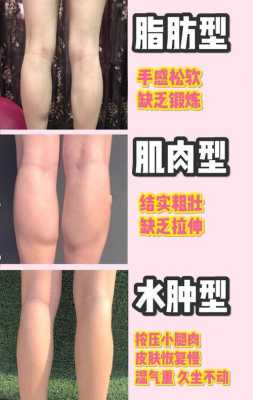 孕期大腿长肉原因（孕期大腿长肉是什么原因）  第3张