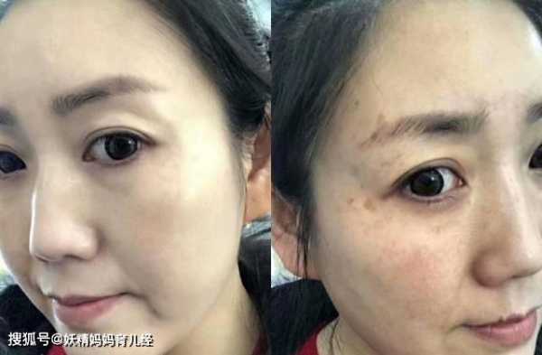 如何防止孕期长斑(如何防止孕期长斑暗黄) 第2张 如何防止孕期长斑(如何防止孕期长斑暗黄) 第2张