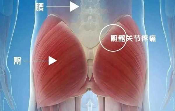 孕期左边屁股连着腿疼(屁股疼腿疼什么原因) 第2张 孕期左边屁股连着腿疼(屁股疼腿疼什么原因) 第2张