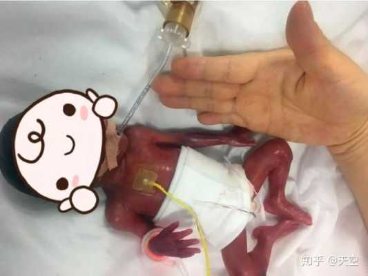 二十五周胎儿有多大,25周胎儿图片 真实 第3张 二十五周胎儿有多大,25周胎儿图片 真实 第3张