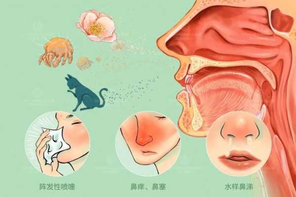 孕妇过敏性鼻炎对胎儿有影响吗?会造成什么影响呢,过敏性鼻炎对胎儿影响严重吗 第1张 孕妇过敏性鼻炎对胎儿有影响吗?会造成什么影响呢,过敏性鼻炎对胎儿影响严重吗 第1张