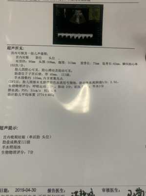 38周加5天胎儿图片（孕38周胎心164好不好?怎么通过胎心来判断宝宝的发育情况）  第2张